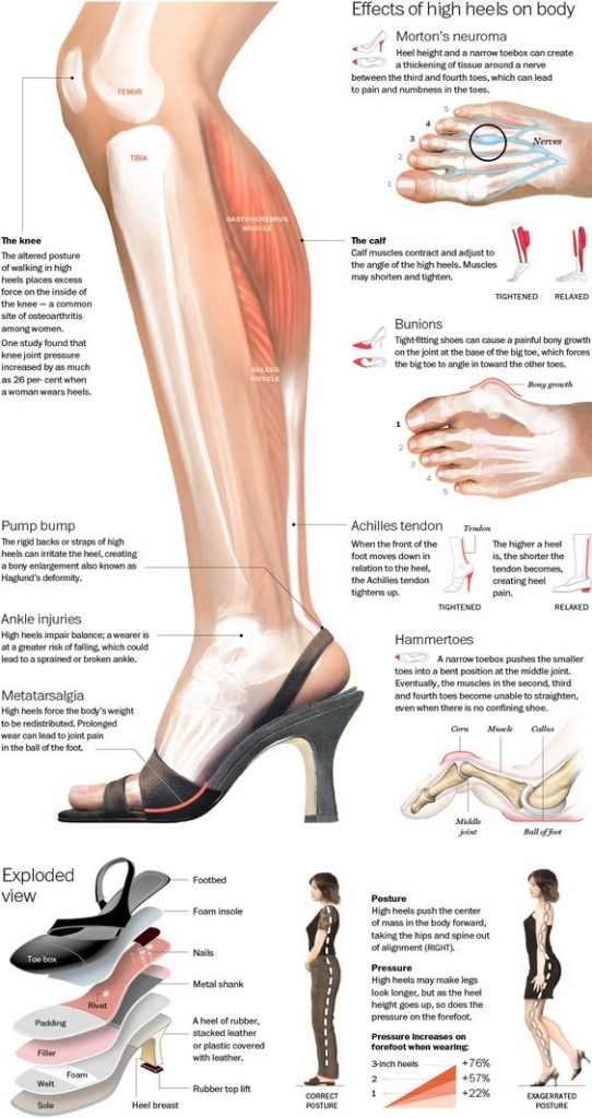 high heels leg diagram